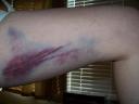 thebruise.jpg